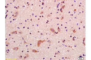 Formalin-fixed and paraffin embedded rat brain labeled with Anti-GRID2IP Polyclonal Antibody, Unconjugated (ABIN1386525) at 1:200 followed by conjugation to the secondary antibody and DAB staining (GRID2IP 抗体  (AA 921-1020))