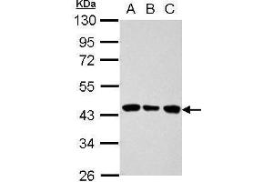 WB Image Sample (30 ug of whole cell lysate) A: 293T B: A431 C: HeLa 10% SDS PAGE antibody diluted at 1:1000 (ALDOB 抗体)