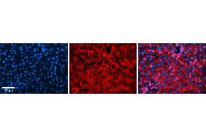 Rabbit Anti-CD81 Antibody Catalog Number: ARP63231_P050 Formalin Fixed Paraffin Embedded Tissue: Human Liver Tissue Observed Staining: Cytoplasm and plasma membrane in hepatocytes and endothelial cells in sinusoids Primary Antibody Concentration: 1:100 Other Working Concentrations: 1:600 Secondary Antibody: Donkey anti-Rabbit-Cy3 Secondary Antibody Concentration: 1:200 Magnification: 20X Exposure Time: 0. (CD81 抗体  (C-Term))