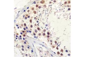 Immunohistochemistry (IHC) image for anti-TATA Box Binding Protein (TBP) antibody (ABIN3029100)