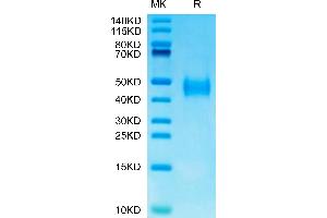 SDS-PAGE (SDS) image for CD276 (CD276) (AA 29-248) protein (His tag) (ABIN7273972)