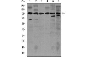 Western blot analysis using NOS2 antibody against Jurkat (1), Jurkat (2), A549 (3), HeLa (4), NIH3T3 (5) and MCF-7 (6) cell lysate. (NOS2 抗体)
