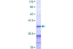 ALDH1L1 Protein (AA 803-902) (GST tag)