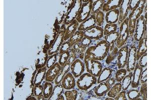 ABIN6272356 at 1/100 staining Rat kidney tissue by IHC-P.
