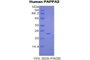 SDS-PAGE analysis of Human Pappalysin 2 Protein. (PAPPA2 蛋白)