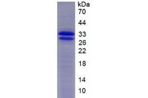 SDS-PAGE analysis of Mouse SOD3 Protein. (SOD3 蛋白)