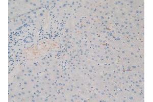 Figure. (SIRPA 抗体  (AA 105-324))