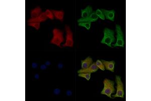 ABIN7093100 and ABIN7097254 staining Hela cells(heat shock treatment) by IF/ICC. (MLKL 抗体  (pSer347))