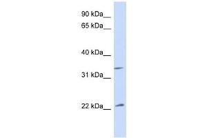 Western Blot showing ARF1 antibody used at a concentration of 1.