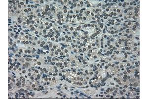 Immunohistochemical staining of paraffin-embedded Ovary tissue using anti-NEK6mouse monoclonal antibody. (NEK6 抗体)
