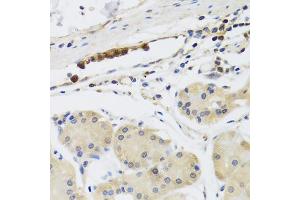 Immunohistochemistry of paraffin-embedded human stomach using MB21D1 antibody. (C6orf150 抗体)