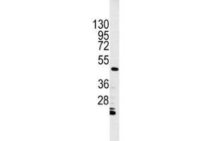 Western blot analysis of Integrin linked kinase antibody and HL-60 cell lysate.