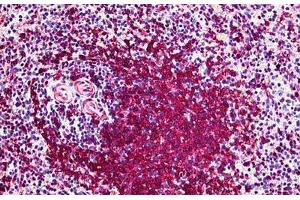 Human Spleen: Formalin-Fixed, Paraffin-Embedded (FFPE) (POLK 抗体  (AA 1-473))