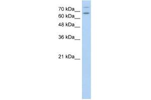 WB Suggested Anti-TSHR Antibody Titration:  0. (TSH receptor 抗体  (N-Term))
