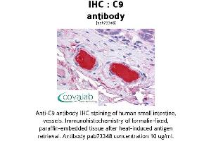 Image no. 1 for anti-Complement Component C9 (C9) (AA 184-411) antibody (ABIN1732510) (C9 抗体  (AA 184-411))
