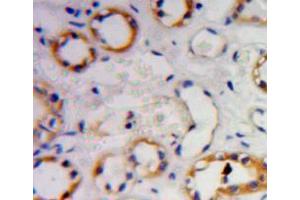 Used in DAB staining on fromalin fixed paraffin- embedded Kidney tissue (GNB2 抗体  (AA 2-340))