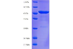 SDS-PAGE (SDS) image for Porin (OMP38) (AA 20-356) protein (His-SUMO Tag) (ABIN5711147)