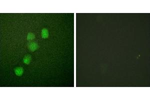 Peptide - +Immunofluorescence analysis of HuvEc cells, using Cyclin(Ab-395) antibody (#B0069). (Cyclin E1 抗体  (Thr395))