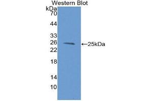 Western Blotting (WB) image for anti-Proteasome (Prosome, Macropain) Subunit, beta Type, 9 (Large Multifunctional Peptidase 2) (PSMB9) (AA 22-219) antibody (ABIN1980450) (PSMB9 抗体  (AA 22-219))