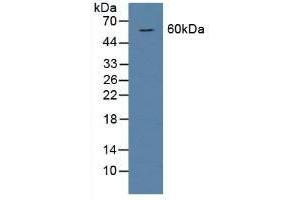 Detection of BMP6 in Rat Serum using Polyclonal Antibody to Bone Morphogenetic Protein 6 (BMP6) (BMP6 抗体  (AA 375-502))