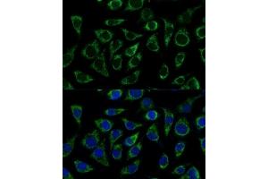 Immunofluorescence (IF) image for anti-ATP Synthase, H+ Transporting, Mitochondrial F1 Complex, gamma Polypeptide 1 (ATP5C1) (AA 26-298) antibody (ABIN7265723)