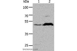 Western blot analysis of HepG2 cell and Mouse brain tissue, using HTR1A Polyclonal Antibody at dilution of 1:1000 (Serotonin Receptor 1A 抗体)