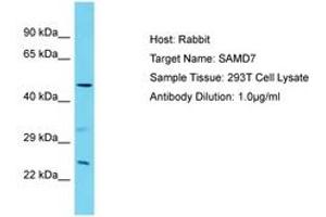 Image no. 1 for anti-Sterile alpha Motif Domain Containing 7 (SAMD7) (AA 175-224) antibody (ABIN6750794) (SAMD7 抗体  (AA 175-224))