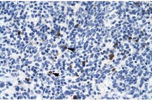 Immunohistochemical staining (Formalin-fixed paraffin-embedded sections) of human spleen with HTR3B polyclonal antibody . (Serotonin Receptor 3B 抗体  (AA 8-57))