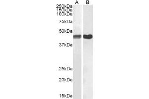 Western Blotting (WB) image for anti-Actin, alpha 2, Smooth Muscle, Aorta (ACTA2) (N-Term) antibody (ABIN185271)