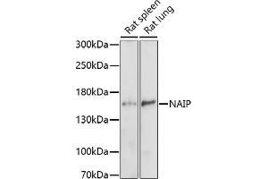 Western blot analysis of extracts of various cell lines, using NAIP antibody (ABIN7268932) at 1:1000 dilution. (NAIP 抗体  (AA 750-850))