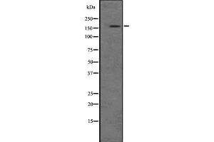 Western blot analysis of PIK3C2B expression in A-431 cell lysate at 25ug/lane. (PIK3C2B 抗体  (Internal Region))