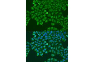 Immunofluorescence analysis of U2OS cells using CAST antibody (ABIN6290228) at dilution of 1:100. (Calpastatin 抗体)