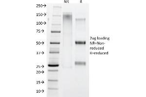 SDS-PAGE Analysis IgG4 Mouse Monoclonal Antibody (IGHG4/1345). (IGHG4 抗体)