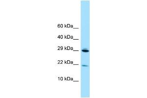 WB Suggested Anti-RPL28 Antibody Titration: 1. (RPL28 抗体  (N-Term))