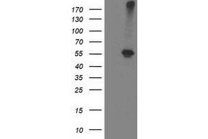 Western Blotting (WB) image for anti-Alcohol Dehydrogenase 1B (Class I), beta Polypeptide (ADH1B) antibody (ABIN1496476) (ADH1B 抗体)