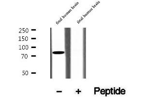 Western blot analysis of extracts of fetal human brain tissue, using CIN85 antibody. (SH3KBP1 抗体  (N-Term))