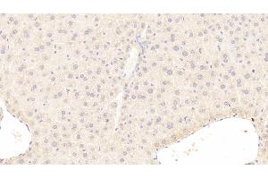 Detection of CRAT in Mouse Liver Tissue using Polyclonal Antibody to Carnitine Acetyltransferase (CRAT)
