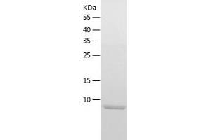 beta 2 Defensin Protein (AA 23-63) (His tag)