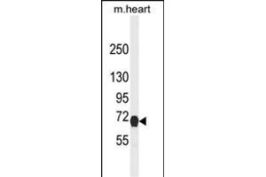Western blot analysis of NGFR Antibody (ABIN2802041 and ABIN6577055) in mouse heart tissue lysates (35 μg/lane). (NGFR 抗体)