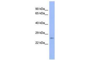 Image no. 1 for anti-Proteasome (Prosome, Macropain) Subunit, beta Type, 6 (PSMB6) (AA 35-84) antibody (ABIN6744084)