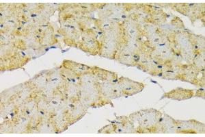 Immunohistochemistry of paraffin-embedded Rat heart using HK2 Polyclonal Antibody at dilution of 1:200 (40x lens). (Hexokinase 2 抗体)