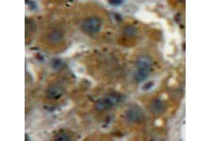 Used in DAB staining on fromalin fixed paraffin-embedded Liver tissue (ACP1 抗体  (AA 40-158))