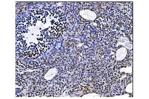 IHC analysis of EHMT2/G9A using anti-EHMT2/G9A antibody (ABIN7602084). (EHMT2 抗体  (AA 580-1195))