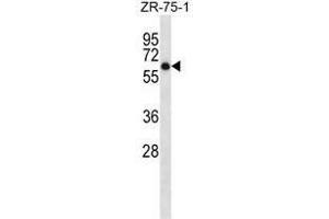 ARSD Antibody (C-term) western blot analysis in ZR-75-1 cell line lysates (35µg/lane). (Arylsulfatase D 抗体  (C-Term))