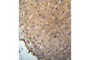 CHB Antibody (N-term) (ABIN657226 and ABIN2846328) immunohistochemistry analysis in formalin fixed and paraffin embedded human liver tissue followed by peroxidase conjugation of the secondary antibody and DAB staining. (CHMP2B 抗体  (N-Term))