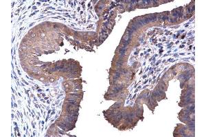 IHC-P Image PFKL antibody [C1C3] detects PFKL protein at cytoplasm in mouse cervix by immunohistochemical analysis. (PFKL 抗体  (Center))