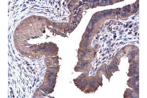 IHC-P Image PFKL antibody [C1C3] detects PFKL protein at cytoplasm in mouse cervix by immunohistochemical analysis.