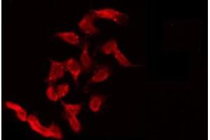 ABIN6275543 staining 293 by IF/ICC. (ULK3 抗体  (Internal Region))