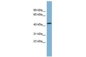WB Suggested Anti-EFCAB4B Antibody Titration:  0. (EFCAB4B 抗体  (Middle Region))