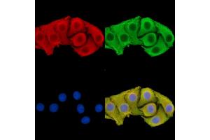 ABIN7095903 and ABIN7099965 staining Hela cells by IF/ICC.